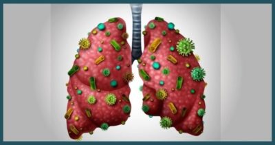 detoxify-your-lungs-8-must-do-strategies-to-heal-your-respiratory-problems