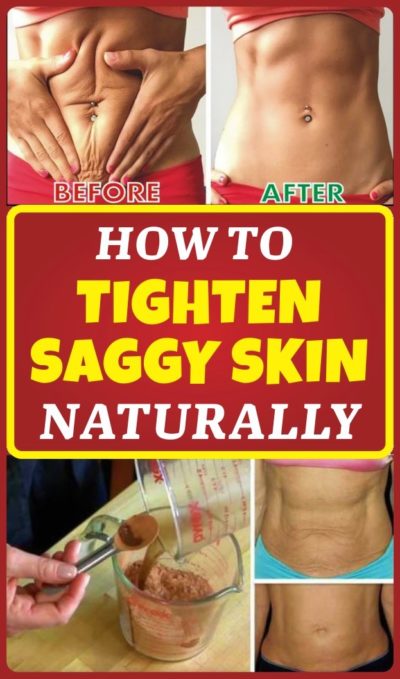how-to-tighten-sagging-skin-naturraly