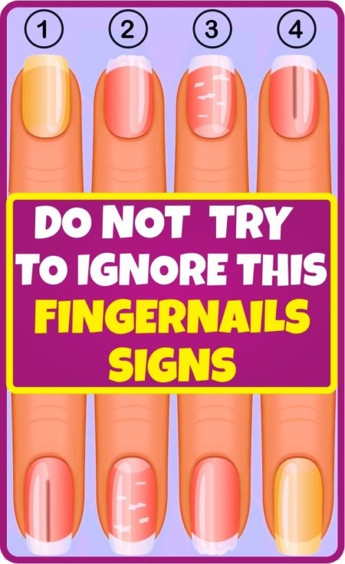 Warning-Do-Not-Try-to-Ignore-This-Fingernails-Signs