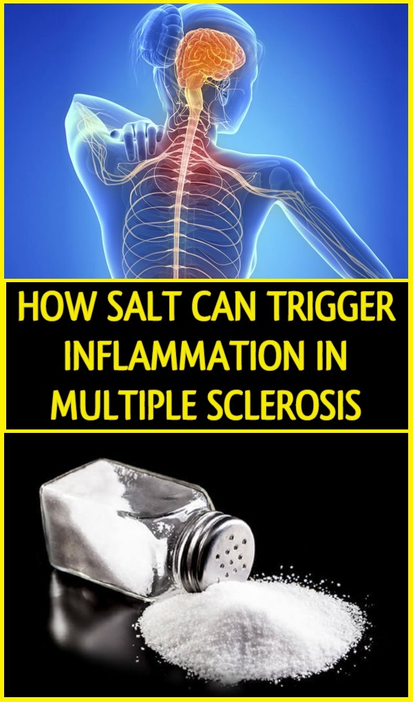 how-salt-can-trigger-inflammation-in-multiple-sclerosis