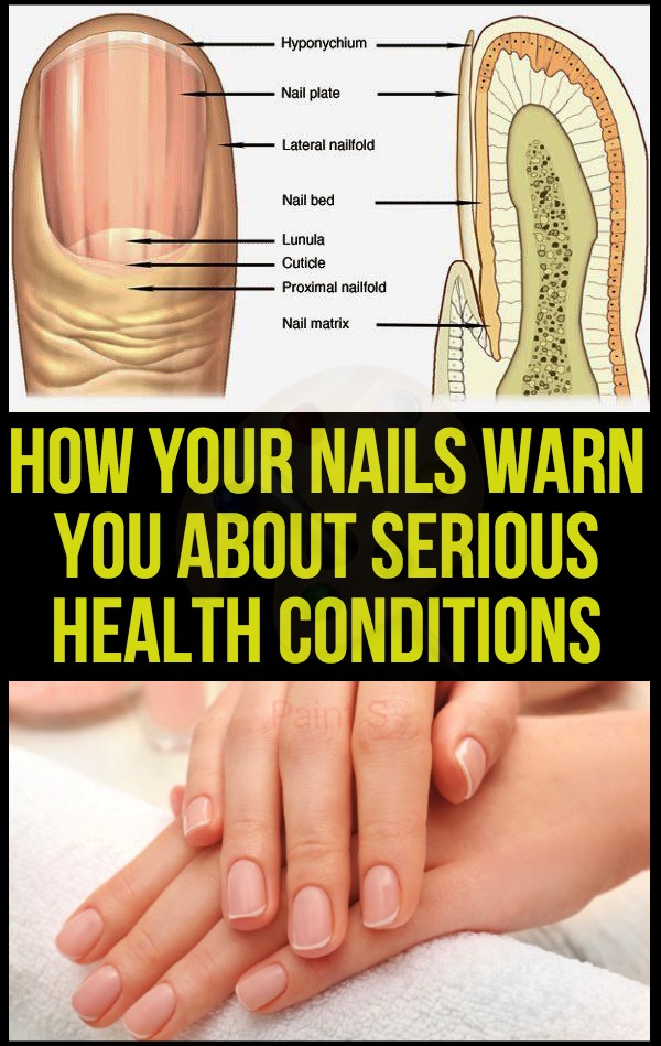 how-your-nails-warn-you-about-serious-health-conditions