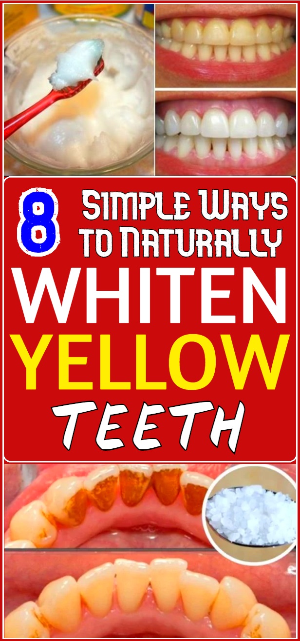 8 Simple Ways to Naturally Whiten Yellow Teeth
