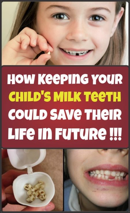 keeping-your-childs-milk-teeth-could-save-their-life-in-future