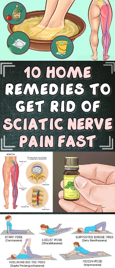 10-best-home-remedies-to-get-rid-of-sciatic-nerve-pain