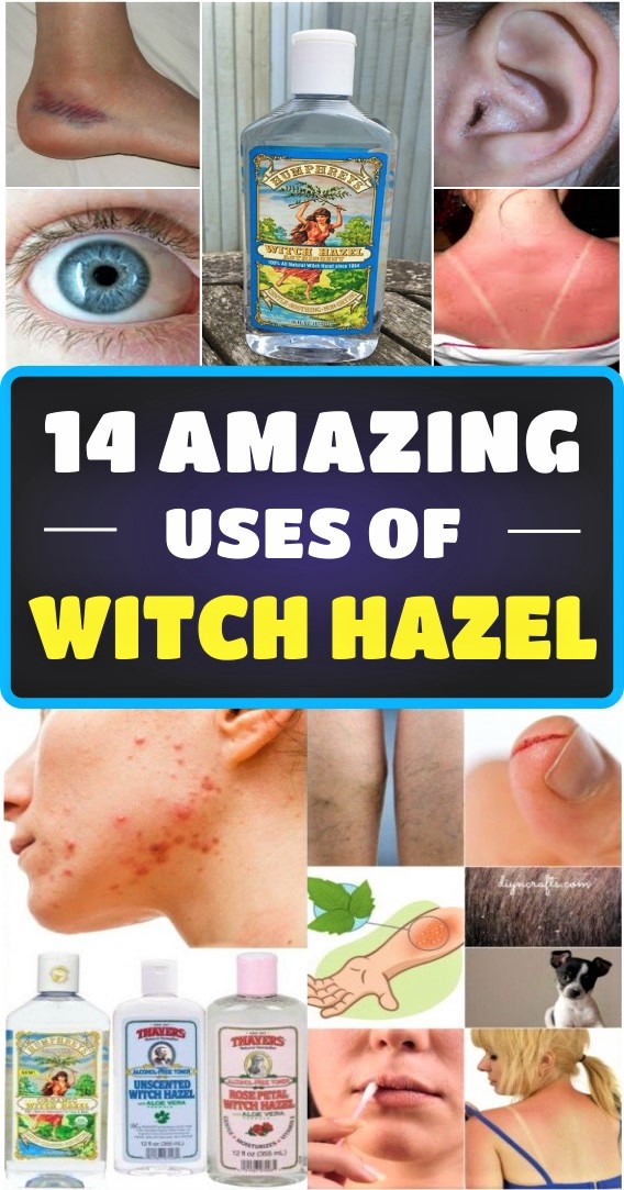14-amazing-uses-of-witch-hazel